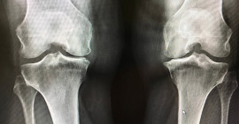 Magnézium Iskola #3