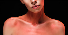 Bőr – bél – gyulladásos betegségek és a kiút